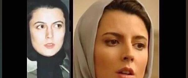 عکس قبل و بعد عمل بینی شاهرخ استخری