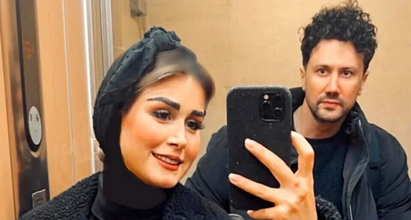 عکس قبل و بعد عمل بینی شاهرخ استخری