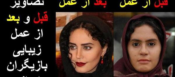 عکس قبل و بعد عمل بینی شاهرخ استخری