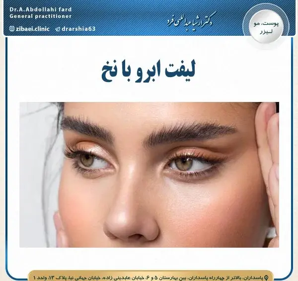 عکس قبل و بعد لیفت ابرو با نخ