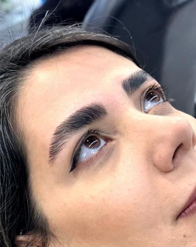عکس قبل و بعد لیفت ابرو با مواد
