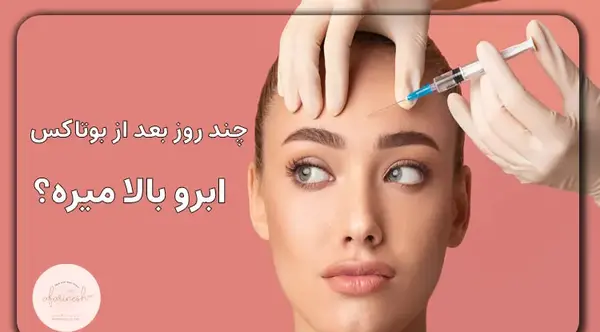 عکس قبل و بعد لیفت ابرو با بوتاکس
