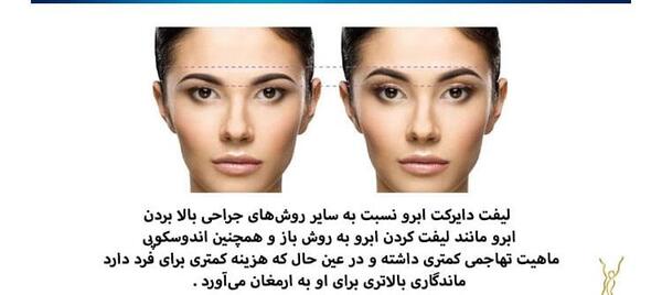 عکس قبل و بعد از لیفت ابرو