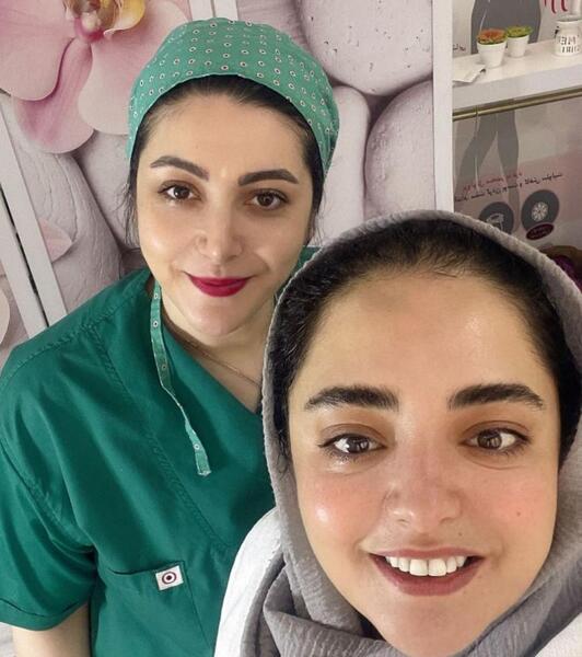 زایمان سزارین عکس بارداری نرگس محمدی