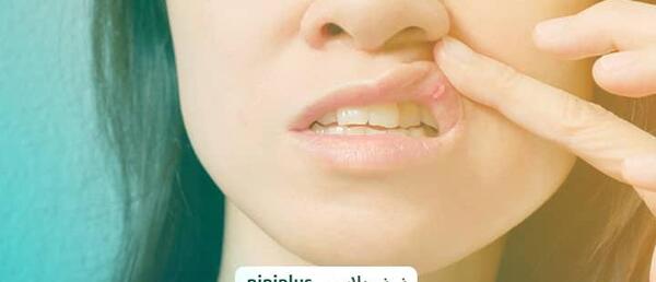 عکس دندان در بارداری نی نی سایت