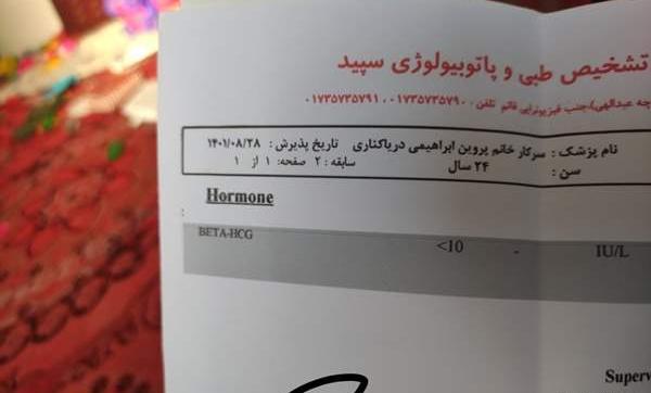 عکس آزمایش بارداری نی نی سایت
