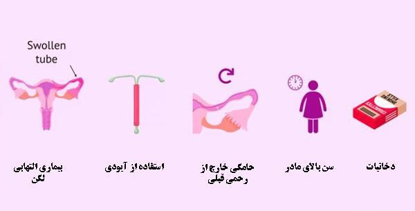 عکس بارداری خارج رحمی