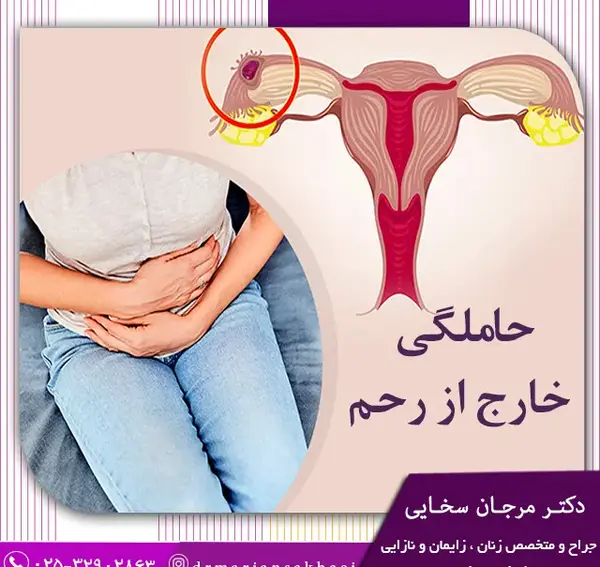عکس بارداری خارج رحمی