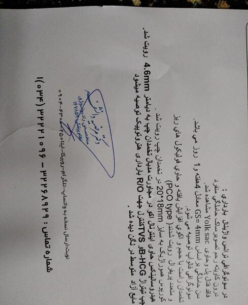 عکس سونوگرافی بارداری خارج رحم