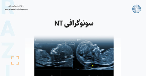 عکس سونوگرافی بارداری خارج رحم