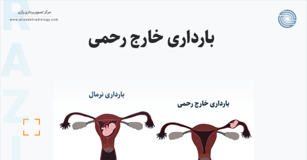 عکس سونوگرافی بارداری خارج از رحم