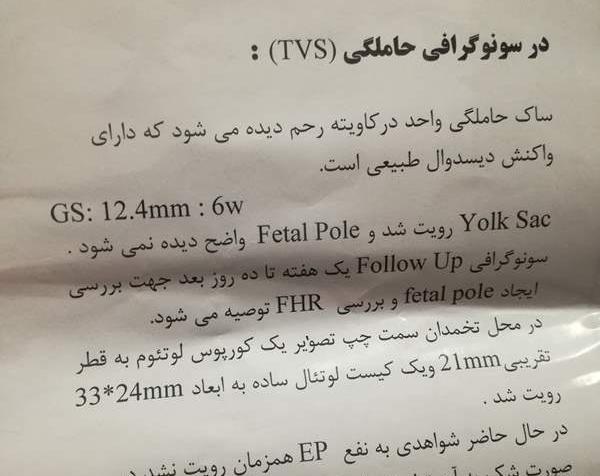عکس سونوگرافی بارداری خارج از رحم