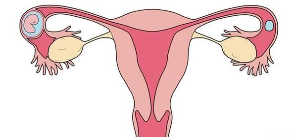 شکم عکس بارداری خارج از رحم
