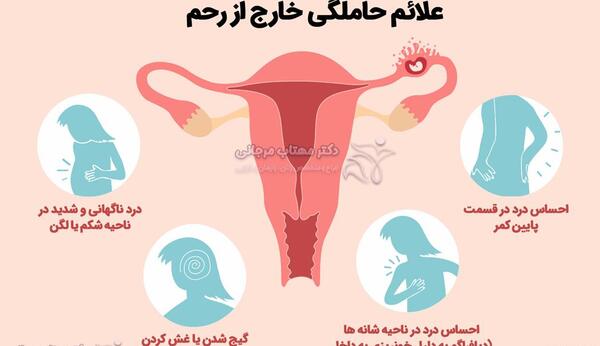 شکم عکس بارداری خارج از رحم
