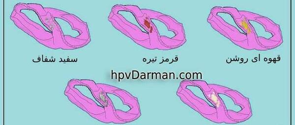 عکس ترشحات هفته اول بارداری