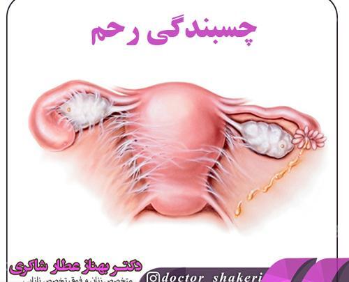 عکس رنگی از رحم و بارداری