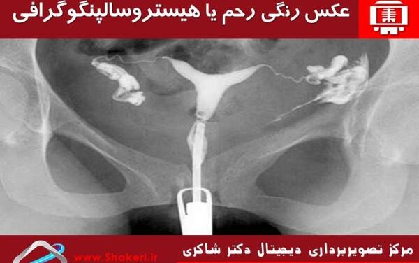 عکس رنگی از رحم و بارداری