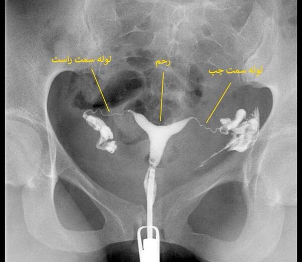 عکس رنگی از رحم و بارداری