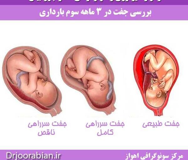 عکس جنین در ماه به ماه بارداری