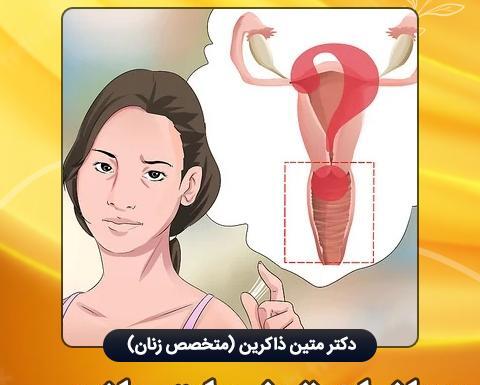 عکس ترشحات بارداری قبل از پریودی
