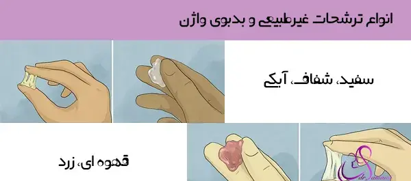 عکس ترشحات بارداری قبل پریودی