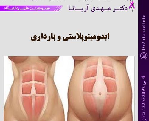 عکس قبل و بعد بارداری