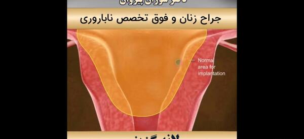 علائم بارداری عکس واقعی خونریزی لانه گزینی