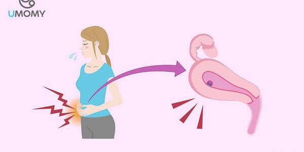 علائم بارداری عکس واقعی خونریزی لانه گزینی