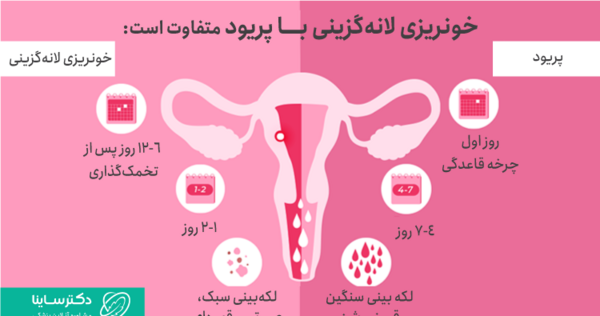 علائم بارداری عکس واقعی خونریزی لانه گزینی