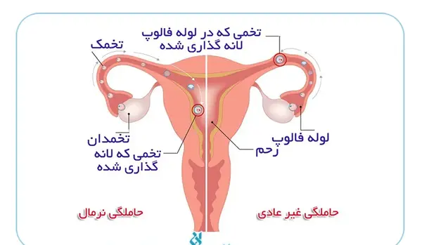 عکس بارداری هفته سوم