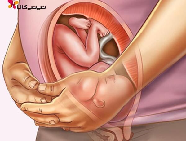عکس شکم بارداری دوقلو نی نی سایت