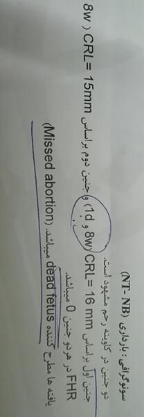 عکس بارداری دوقلو هفته هشتم