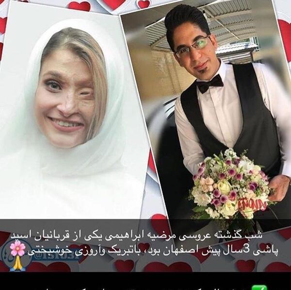 بارداری عکس عروسی روناک یونسی