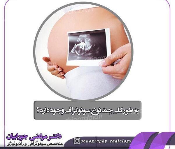 عکس سونوگرافی بارداری دوقلو