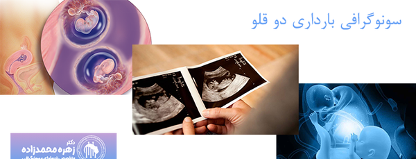 عکس سونو بارداری دوقلو