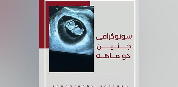 عکس دو ماهگی بارداری