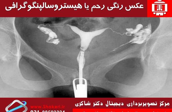 عکس رنگی بعد از بارداری خارج از رحم