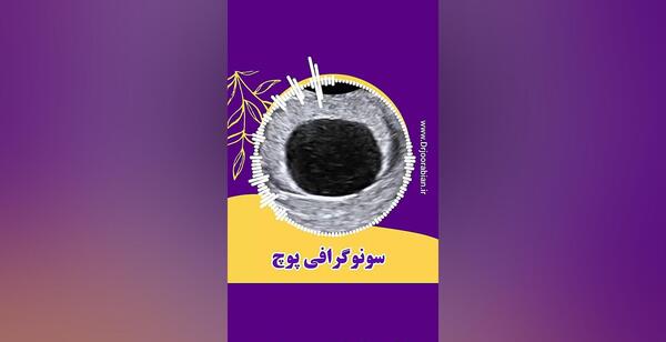 عکس سونوگرافی بارداری پوچ