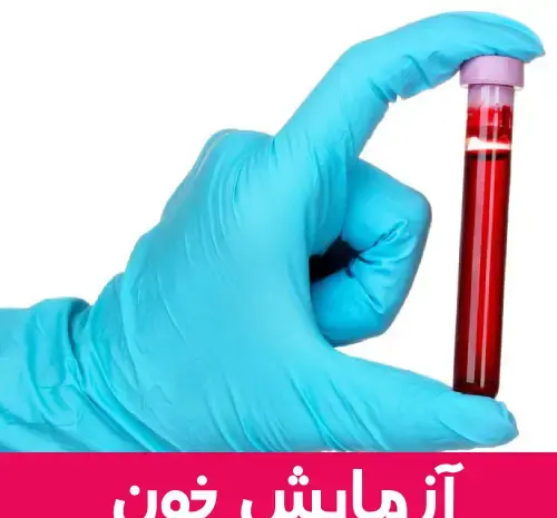 عکس سونوگرافی بارداری پوچ