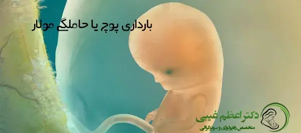 عکس سونوگرافی بارداری پوچ
