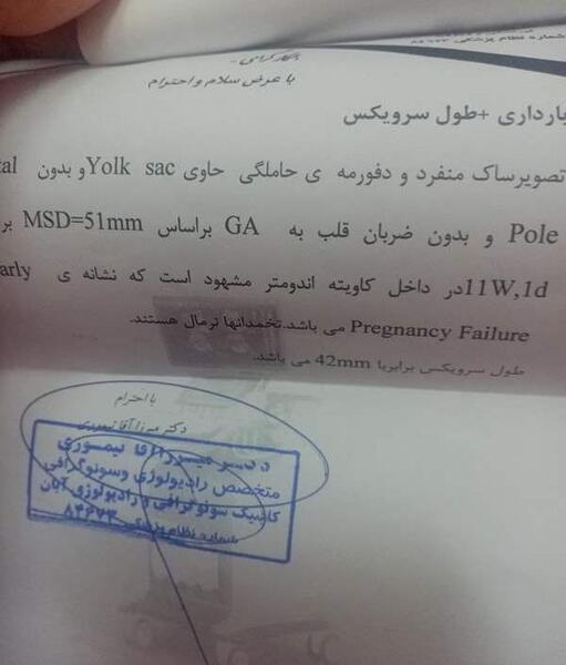 عکس سونو بارداری پوچ