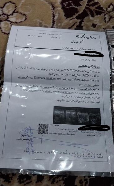 عکس سونو بارداری پوچ