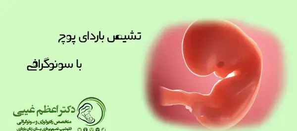 عکس سونو بارداری پوچ