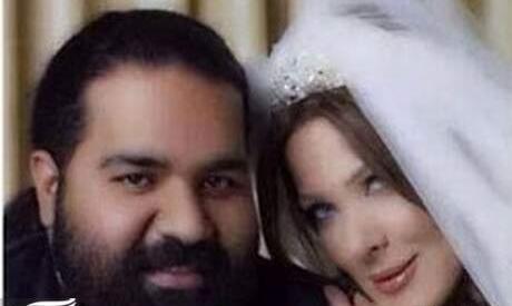 عکس همسر رضا صادقی قبل از عمل