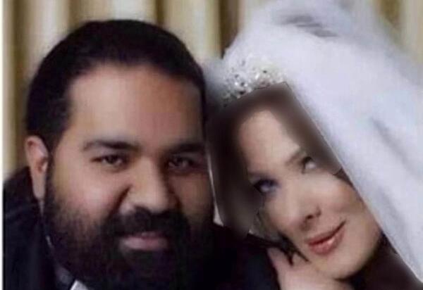عکس همسر رضا صادقی قبل از عمل