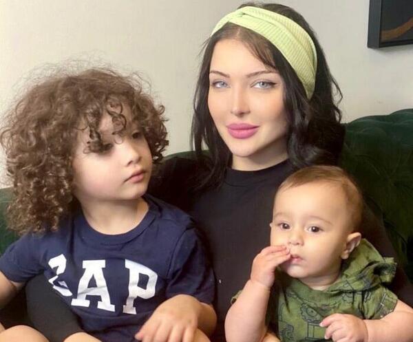 عکس همسر سپهر حیدری قبل عمل