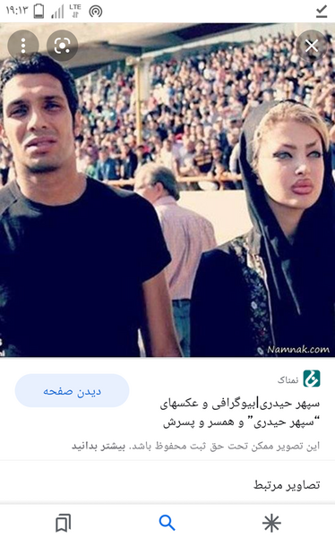 عکس همسر سپهر حیدری قبل از عمل