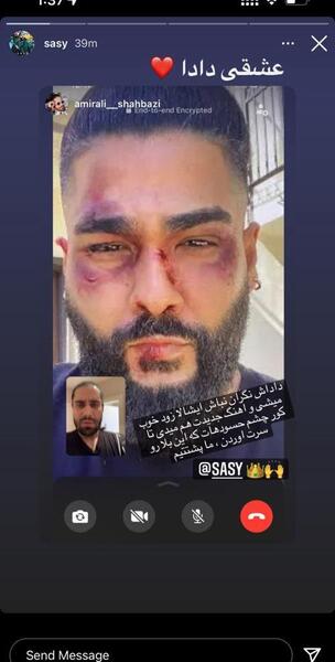 عکس همسر اول ساسی مانکن
