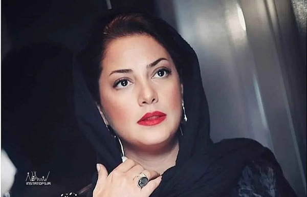 عکس قبل از عمل طلا گلزار