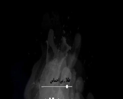 عکس طلا خواننده اهنگ بی احساس